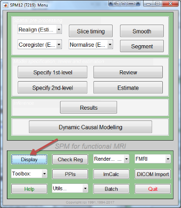 ../_images/03_display_button.png