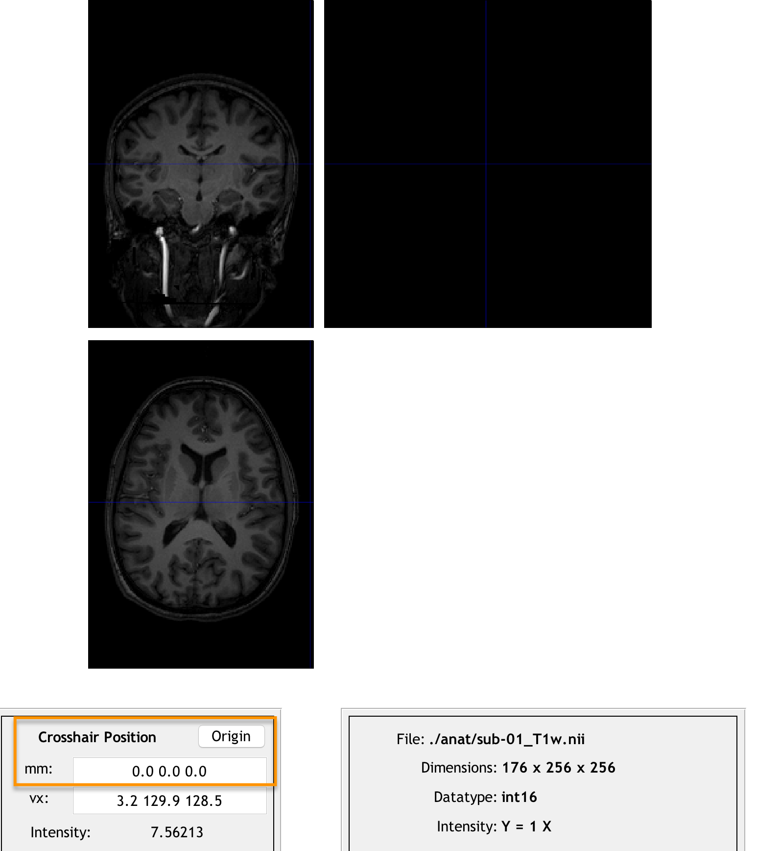 ../_images/07_Anatomical_Origins_Before.png